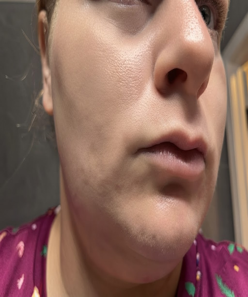 After 3 Masks
