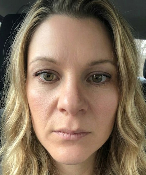 After 2 Masks