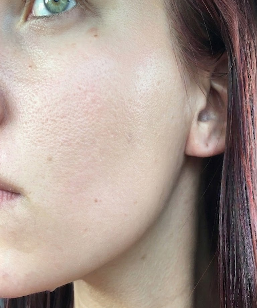 After 1 Mask
